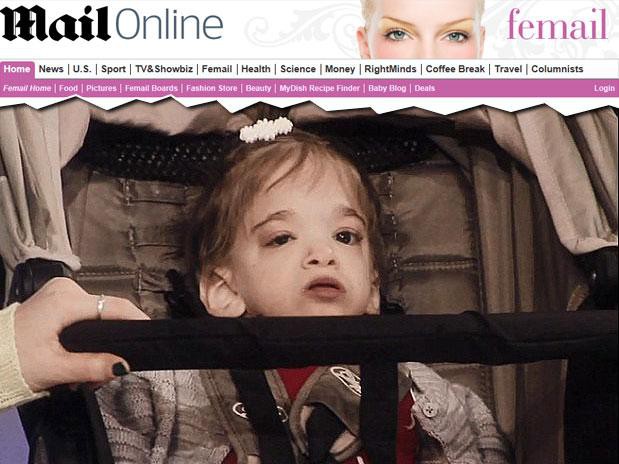 Apesar da idade, Brooke Greenberg mantém a aparência física e a cognição de uma criança (Foto: Daily Mail/Reprodução)
