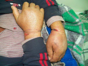 Vítima apresentava hipotermia e ferimentos nas mãos. Foto: Itaporã Hoje