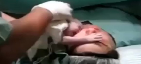 Vídeo: bebê 'recusa' ser levado por enfermeiro e se agarra no rosto da mãe