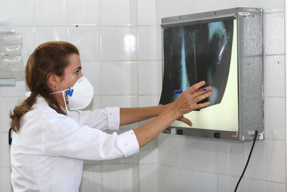 Incidência de tuberculose no Brasil em 2014 foi 33,5 casos por 100 mil habitantesAgecom Bahia