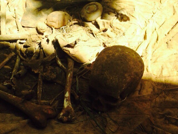 Ossos e próteses de silicone encontrados enterrados em fossa (Foto: Divulgação/Polícia Civil)