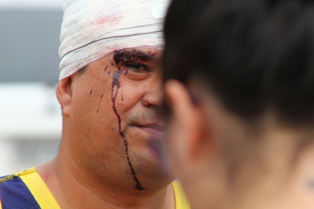 Policial ficou ferido após livrar vítimas de roubo e lutar com bandidos (Foto: Marcos Ermínio)