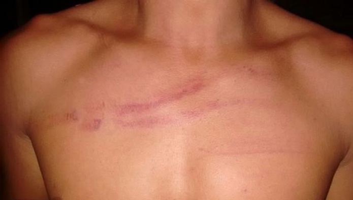 Fotogaleria: árbitro é agredido em campo durante partida de futebol