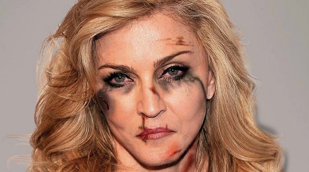 Fotogaleria: famosa aparece com hematomas em campanha chocante contra violência