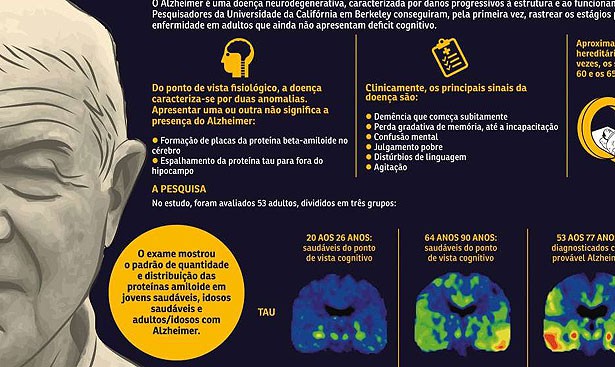 Cientista detecta mudança que ocorre no cérebro antes do surgimento do Alzheimer