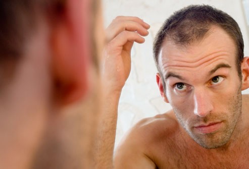 Mitos e verdades sobre queda de cabelo