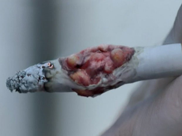 Na propaganda, tumor começa a crescer no próprio cigarro