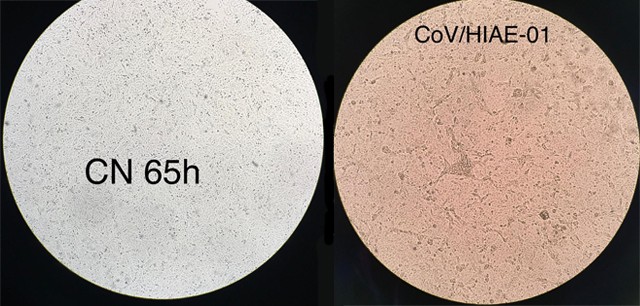 À esquerda, uma célula humana não infectada; à direita, o coronavírus multiplicando-se em célula cultivada em laboratório