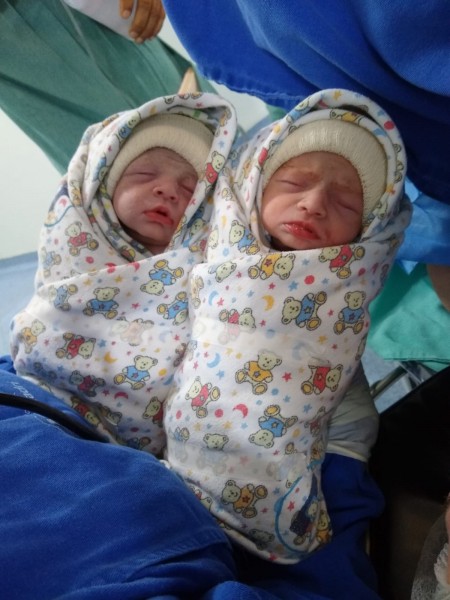 Fotogaleria: nasceram as gêmeas Larah e Sarah 