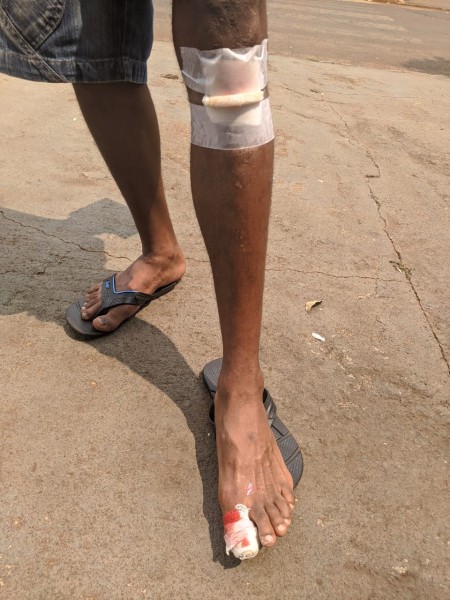 A perna e o dedo da vítima