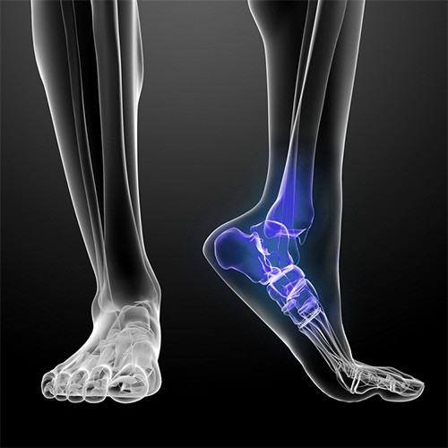 Saúde: torção no tornozelo
