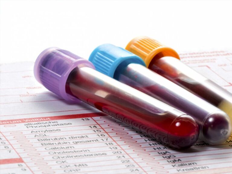 Imposto de Renda: testes laboratoriais de covid-19 poderão ser deduzidos  