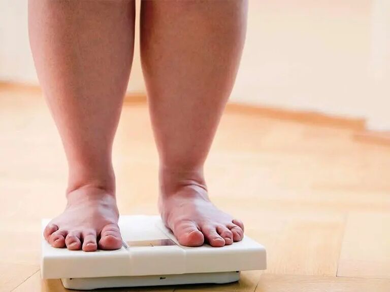 Aumento de 44% em cirurgias bariátricas revela preocupações com a obesidade em Campo Grande