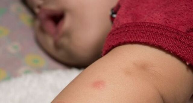 Em uma semana, MS registra aumento nos casos confirmados de dengue