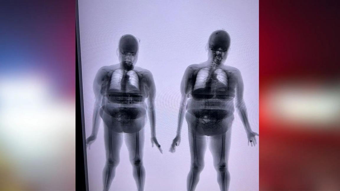 Mulher é flagrada por scanner corporal tentando entrar com celulares em presídio de Paranaíba