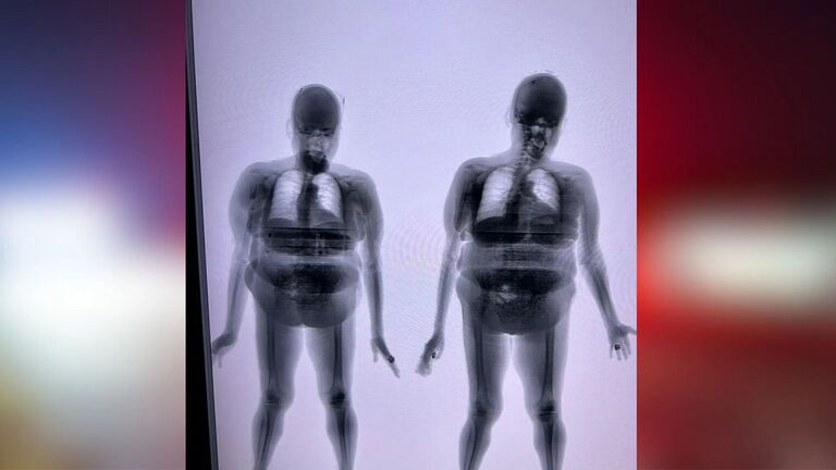 Mulher é flagrada por scanner corporal tentando entrar com celulares em presídio de Paranaíba